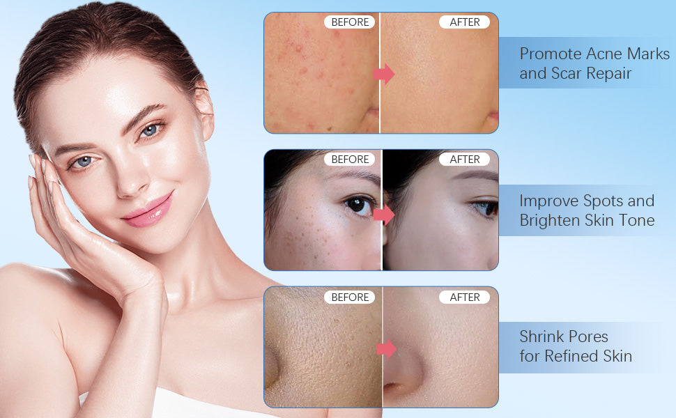 Dr. Pen M8S Microneedling Pen with 10PCS Cartridges