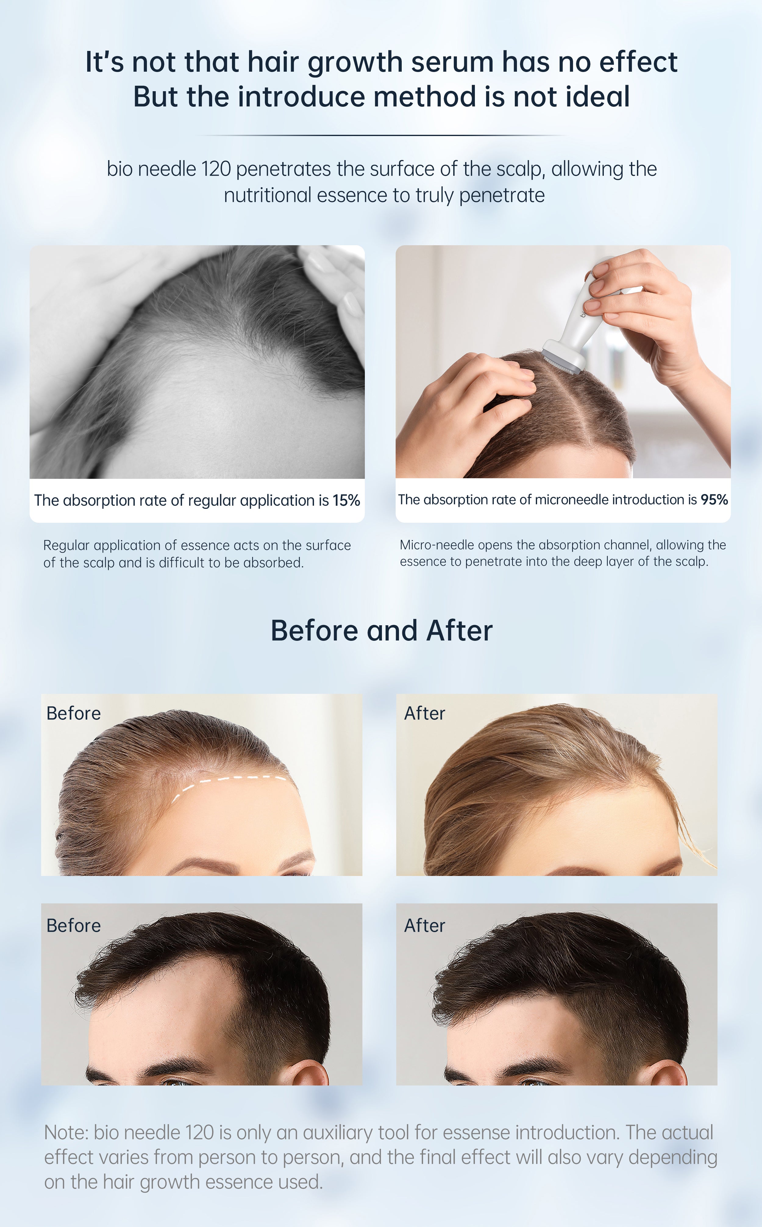 Bio Needle 120Pin Derma Stamp