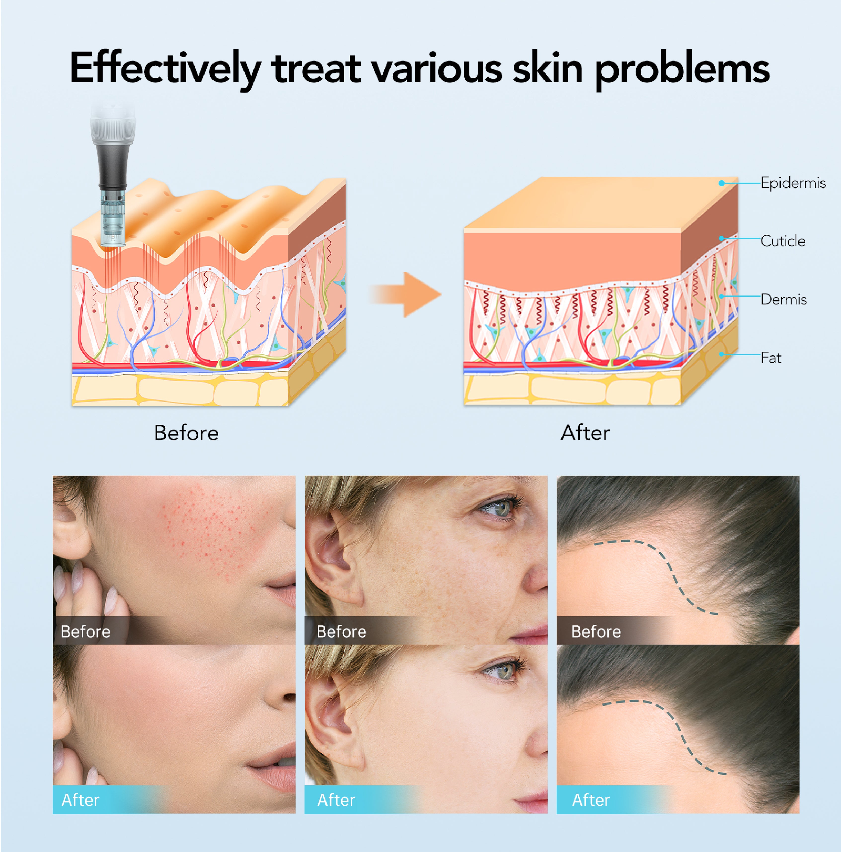 Dr. Pen M7S Microneedling Pen Complete Skincare Bundle (Pen + Serum + Facial Mask)