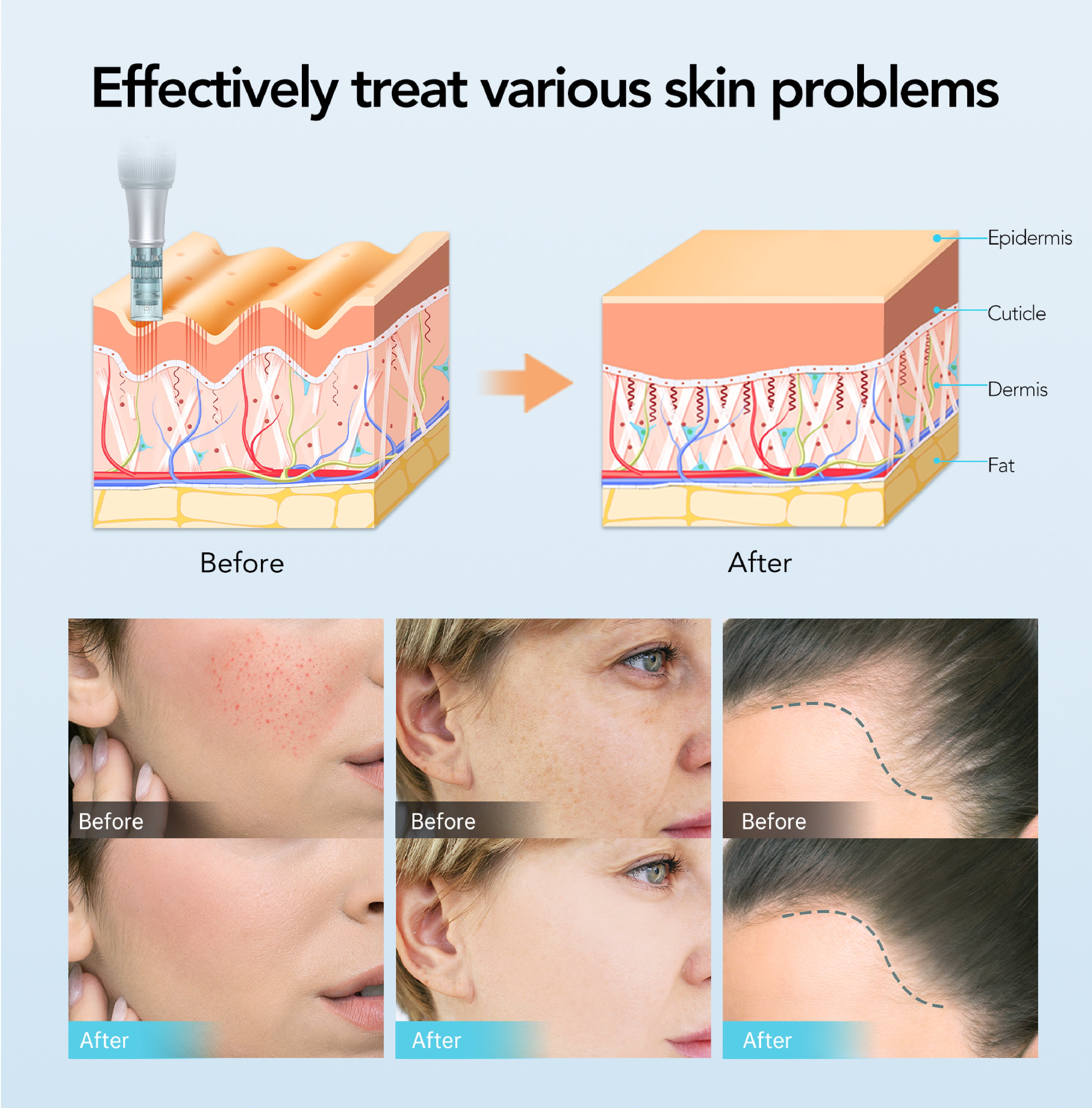 Dr Pen M7S Microneedling Pen Silver